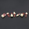 7Pcs Dental Endodontic Root Canal RCT Practice Endo Teeth Tooth