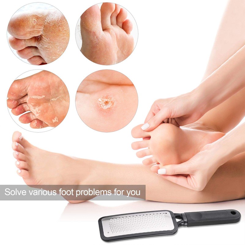 Foot Scrubber Foot Files Callus Remover Black Heel Grater Dead
