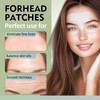 Bellemora Forehead Wrinkle Patches 15pcs Smooth Fine Lines & Wrinkles