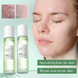 Salicylsäure Anti-Pickel Reparatur Toner Und Reparatur Lotion Set, Tiefenreinigung Der Poren, Reduziert Akne Und Hautunreinheiten, Beruhigt Rötungen Und Irritationen, Ideal Für Fettige Und Mischhaut