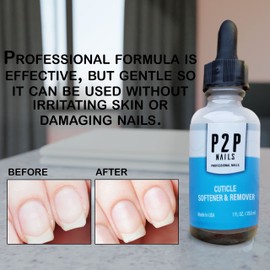 P2P Nails Cuticle Softener & Remover - Professional Pedicure & Manicure Nail Cuticle Repair Care Treatment - Instantly Removes Dead Skin