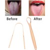 2 cepillos para lengua, resistentes, reutilizables, de acero inoxidable, herramientas