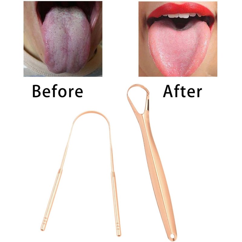 2 cepillos para lengua, resistentes, reutilizables, de acero inoxidable, herramientas