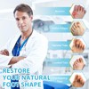 2 Stück Hallux Valgus Korrektur, Toe Separator, Überlappende Zehen korrektur,