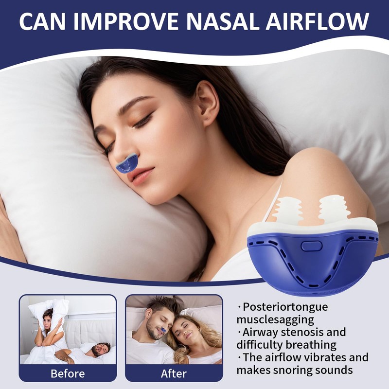 SEESUNO Stop Snoring Mask Devices for All Nose Shapes, 3