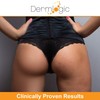 Anti-Acne Thigh & Buttocks Treatment - Clears Away Acne, Pimples,