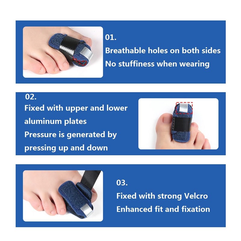 Toe Straightener, Toe Straightening, Toe Splint 1 Pair Toe Straightener