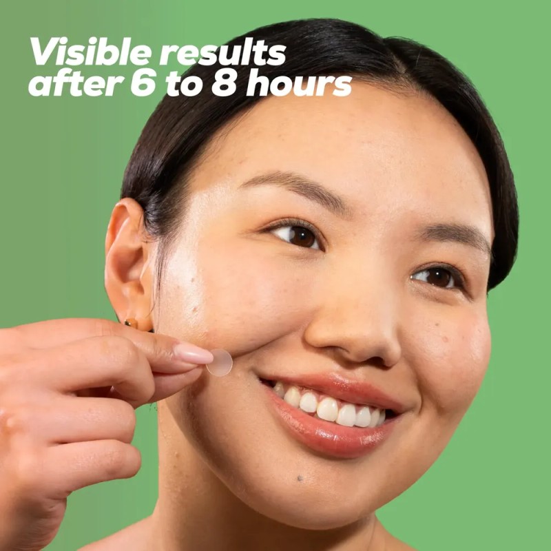 Parche Hidrocoloide Para Granitos Hanhoo Soothing Blemish Pa
