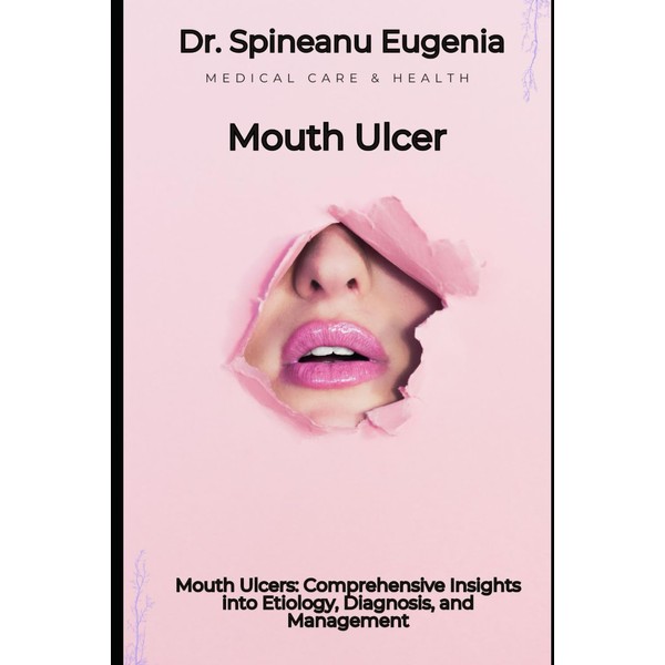 Mouth Ulcers: Comprehensive Insights into Etiology, Diagnosis, and Management