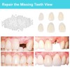 Brige Tooth Repair kit for Filling The Missing Broken Tooth