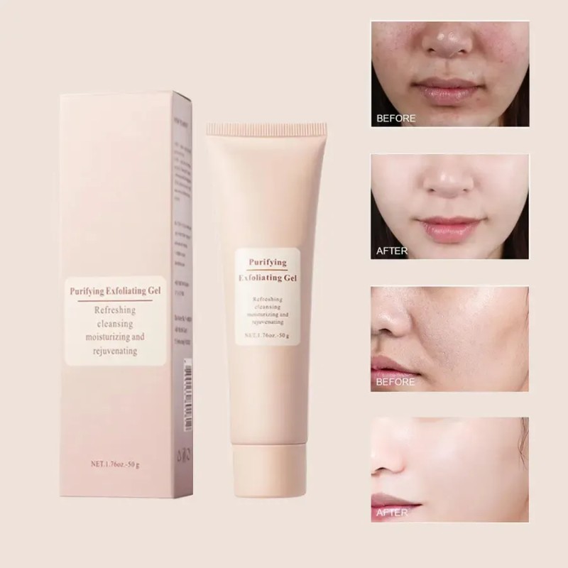 Gel Exfoliante Purificante Mopoyat, Gel Exfoliante Mopoyat