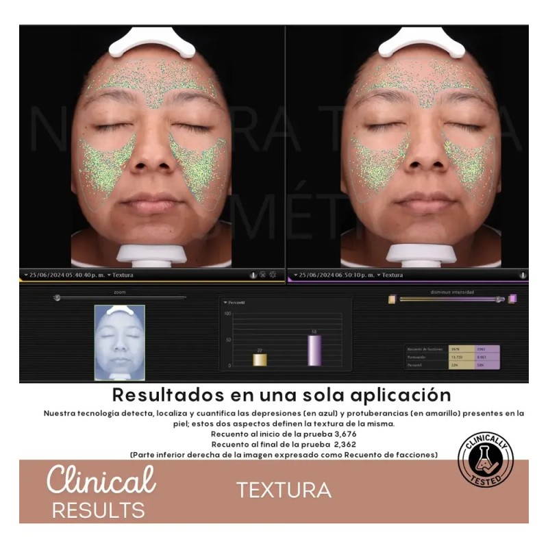 Peeling Enzimático Exfoliante Bbglow Y Faciales 100grs Tipo de piel