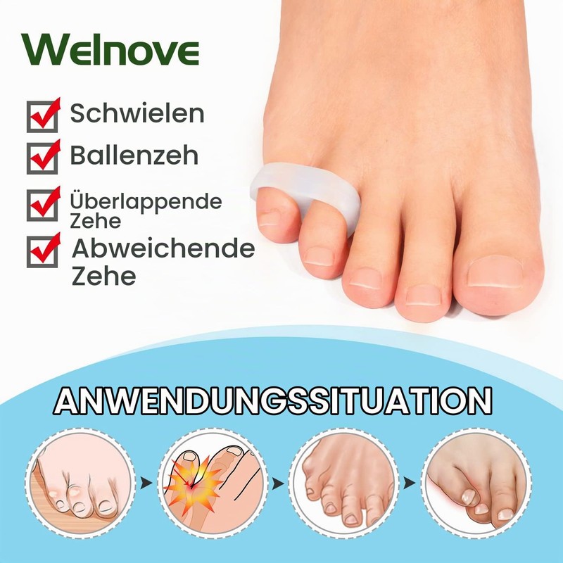 Welnove Pack of 10 Bunion Correction, Toe Separators with 2