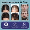 2026 Aa. Tratamiento Para El Crecimiento Del Cabello