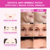 DOYOYA Reusable Silicone Anti Wrinkle Patches 16pcs, Forehead Patch, Eye,
