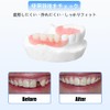 Dentellea Custom Holley Retainer - Set of 2 - Wire