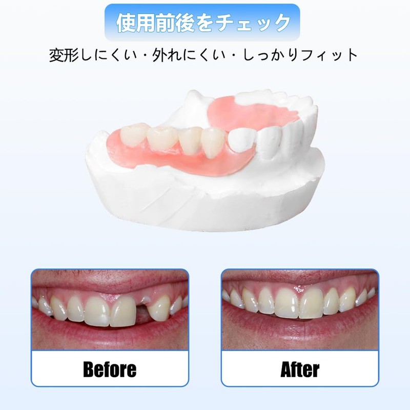 Dentellea Custom Holley Retainer - Set of 2 - Wire