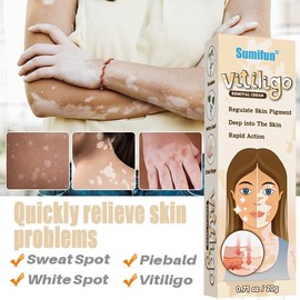 Crema Para El Vitíligo, Crema Para El Tratamiento Del Vitíligo, Psoriasis, Reducir El Vitíligo, Mejorar La Pigmentación De La Piel (Paquete de 3)
