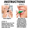 IXO Aligner Chewies for Invisalign Aligners - Chewies Invisalign Accessories
