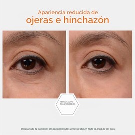 Enlighten Brightening Eye Cream 15g 15ml
