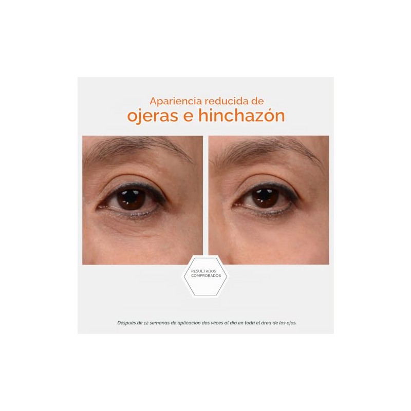 Enlighten Brightening Eye Cream 15g 15ml