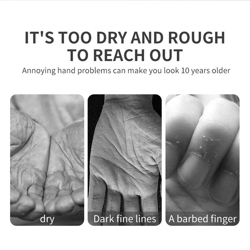 ARCHIDATE Retinol Hand Cream for Aging Hands, Hydrating Hand Cream