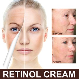 AMALIA Retinol Cream, Skin Firming Face Moisturizer, Anti-Aging Treatment