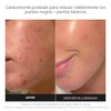Paula's Choice SKIN PERFECTING 2% BHA Liquid Leave-On Exfoliant