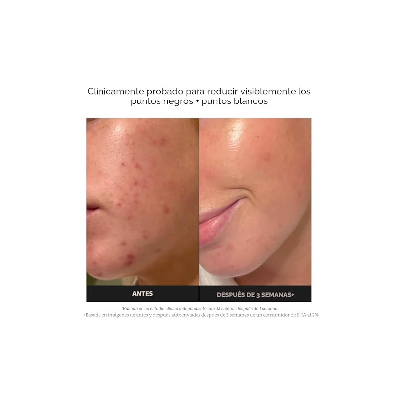 Paula's Choice SKIN PERFECTING 2% BHA Liquid Leave-On Exfoliant