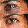 Pen Gel Contorno de Ojos 15 g