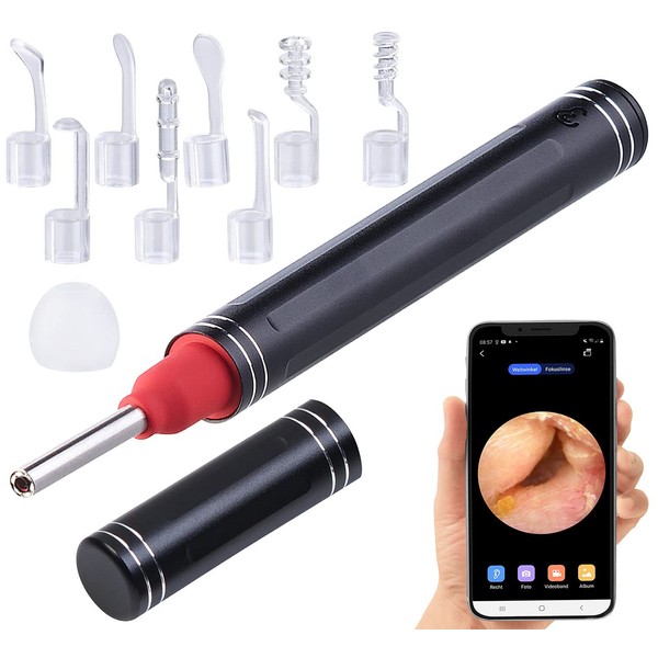 Newgen Medicals Ear Camera: WiFi Ear Cleaner with Full HD Camera, App Live View & 8 Attachments (Ear Cleaning, Otoscope, Health)