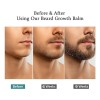 Cosméticos Apolo Barba Estimulante Barba1