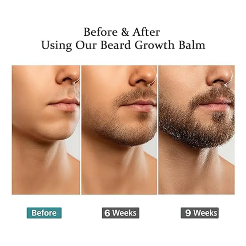 Cosméticos Apolo Barba Estimulante Barba1