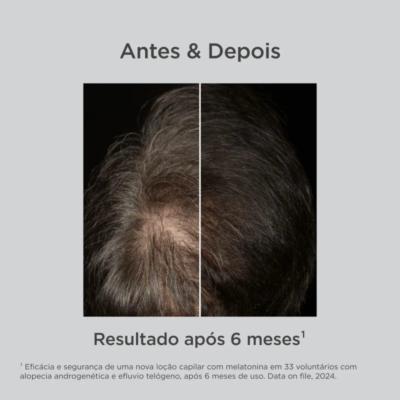 Isdin Loción Anticaída Melatonina Hair Care 100ml