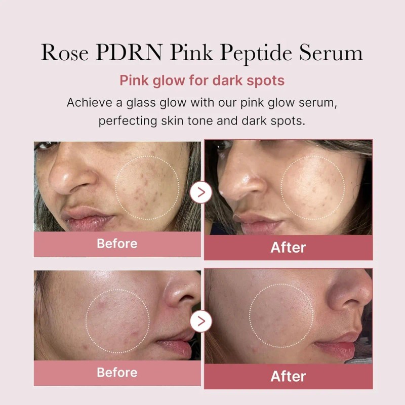 Medicube Suero Reafirmante Peptide Rosa Revitaliza Piel Opaca Día y