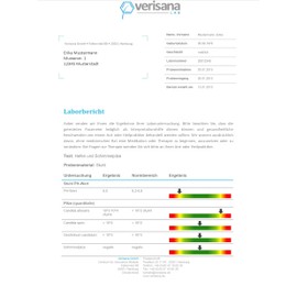 Veri Sana Candida Test | Chair Test Tongue Stroke For Candida Albicans, Candida Spec., Geotrichum Candidum, Fungus | Fungus See Through Mushroom on a chair and Mouth Test