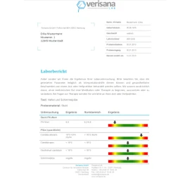 Veri Sana Candida Test | Chair Test Tongue Stroke For Candida Albicans, Candida Spec., Geotrichum Candidum, Fungus | Fungus See Through Mushroom on a chair and Mouth Test