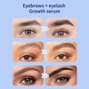 Eyelash and Eyebrow Growth Serum Set – Nourishing Lash &