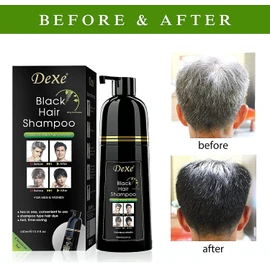 Dexe Black Hair Shampoo 400 ML Instant Hair Darkening Dye for Men Women Black Color - Easy to Use - Lasts 30 Days - Fast Acting Natural Ingredients