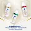 NIVEA Luminous 630 Post-Acne Dark Marks Serum (30ml), Facial Serum