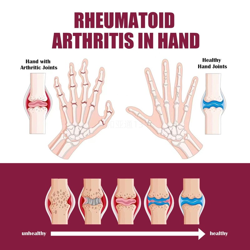 3PCS Perfectx Joint & Bone Cream, Perfectx Joint and Bone