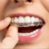 QualityDentalLab.com *2*Dental Retainers! Upper & Lower, ALL shipping included with *NO HIDDEN FEES!*