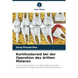 Kortikosteroid bei der Operation des dritten Molaren: Submukosale Injektion von Dexamethason bei den postoperativen Folgen einer dritten Molarenoperation