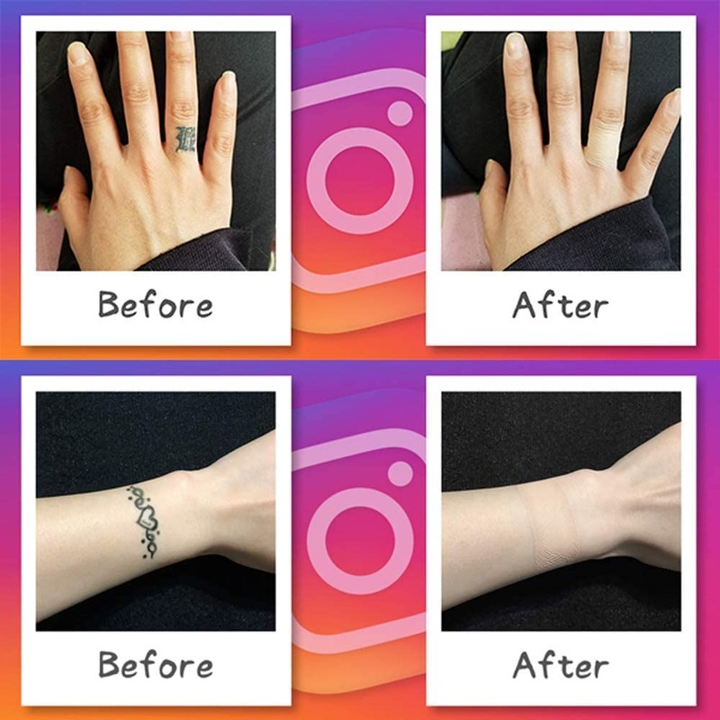 Foundation Tape (Hide Tattoo Stickers) Bandage Size, Same Color, 6