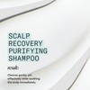 Nioxin Scalp Recovery Purifying Shampoo | For Dandruff and Itchy