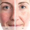 ANEW RENEWAL POWER SERUM 30 ml