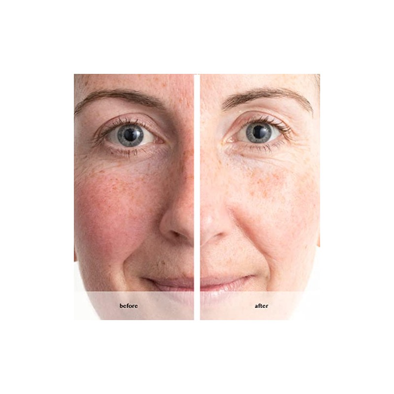 ANEW RENEWAL POWER SERUM 30 ml