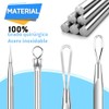 Triko Extractor de Puntos Negros y Espinillas, Herramienta 2 en