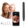 Ear Cleaner Smart Wireless Earwax Removal Tools HD Endoscope with