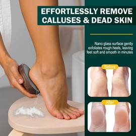 FVION Nano Glass Foot File for Callus Remover - Foot Scraper Dead Skin for Foot Spa - The Ultimate Gentle Foot Scrubber Pedicure File with Bamboo Handle, Used on Both Wet/Dry Cracked Feet (Brown)
